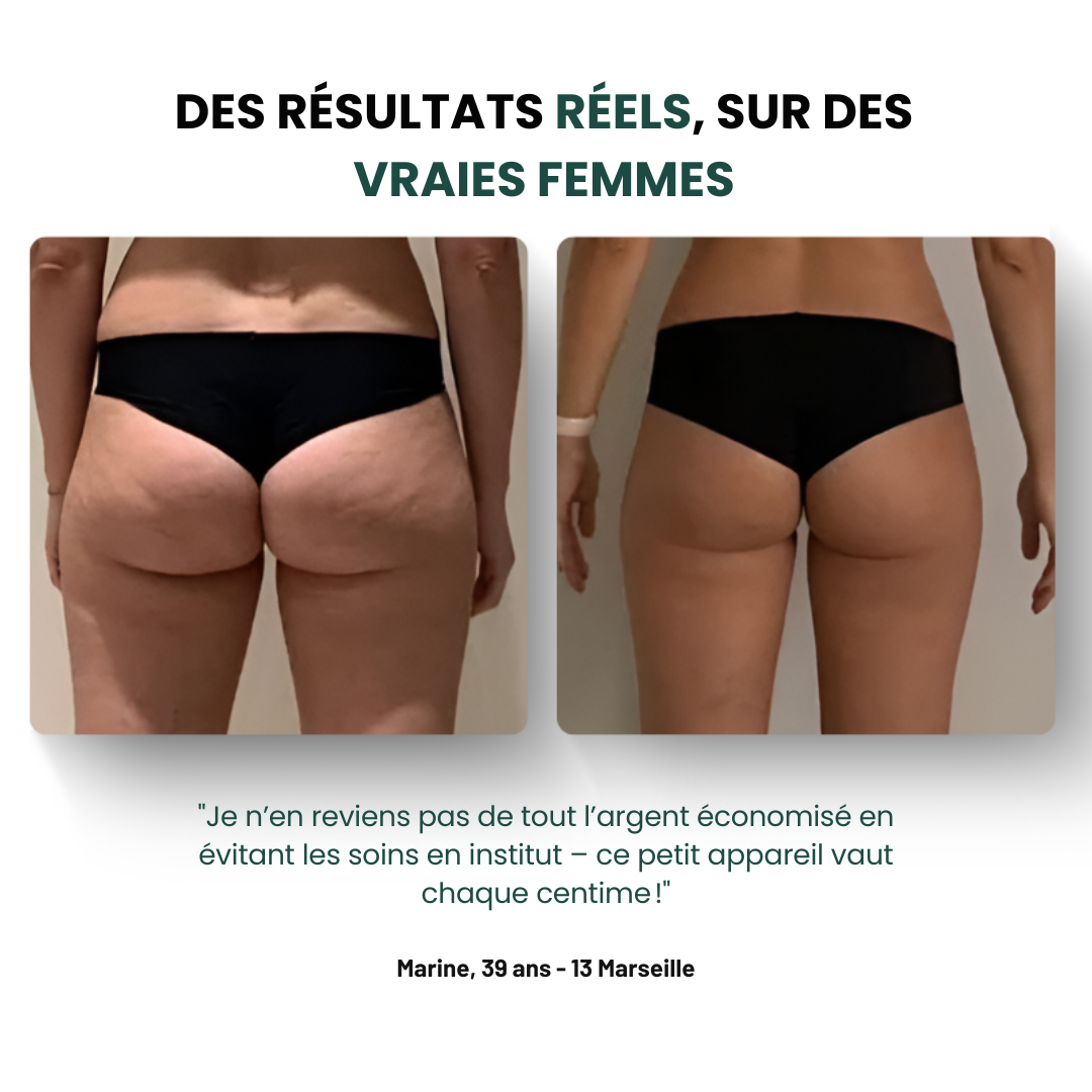 BeGlowave™ Anti-Cellulite 3 en 1
