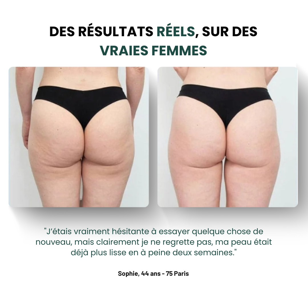 BeGlowave™ Anti-Cellulite 3 en 1